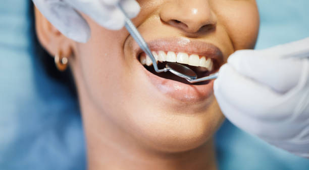Best Chipped Tooth Repair Near Me  in La Cienega, NM